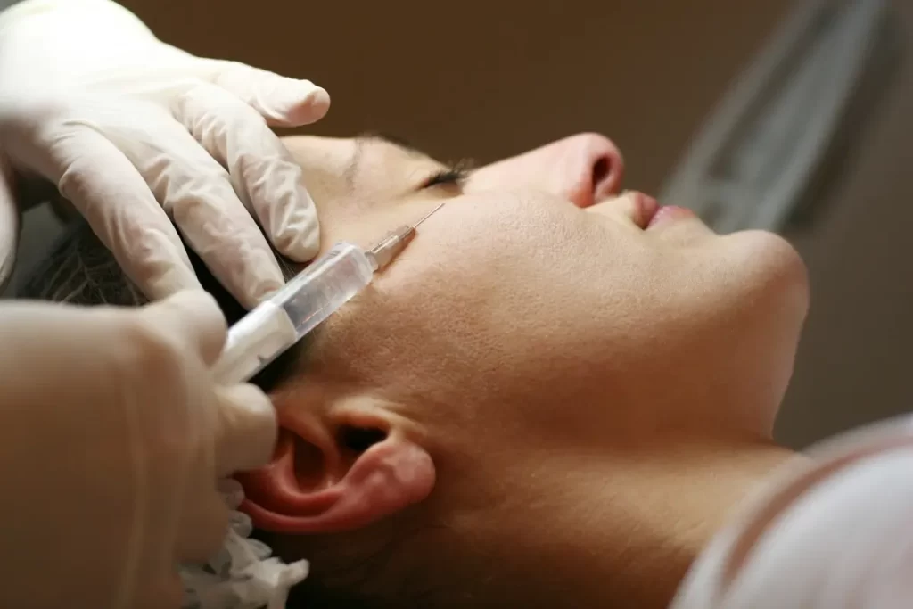 altin-igne-rf-iz-tedavisi Uzm. Dr. Ayşegül Polat, Altın İğne RF İz Tedavisi ve Cilt Gençleştirme uygulaması yapıyor